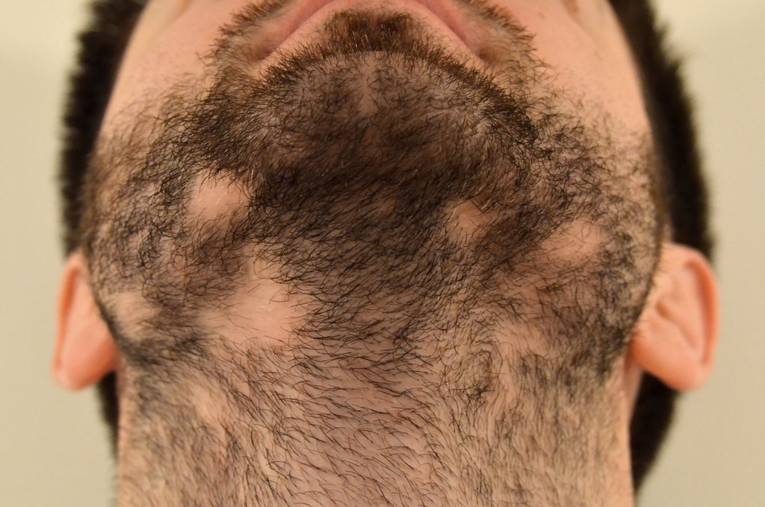 Caring for your beard to help it grow
